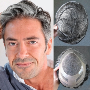 Mens hair systems that help hair loss patients