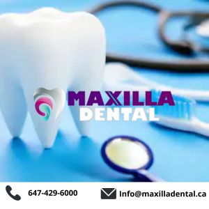 Maxilla Dental